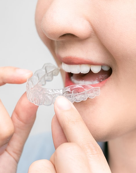 Ortodonzia Invisibile Firenze sistema Invisalign