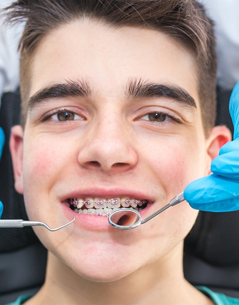 Qual è il costo di un apparecchio denti? Le varie tipologie - Centri  Dentistici Primo