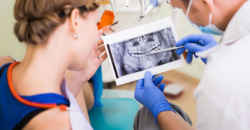 mettere gli impianti dentali senza bucare l'osso