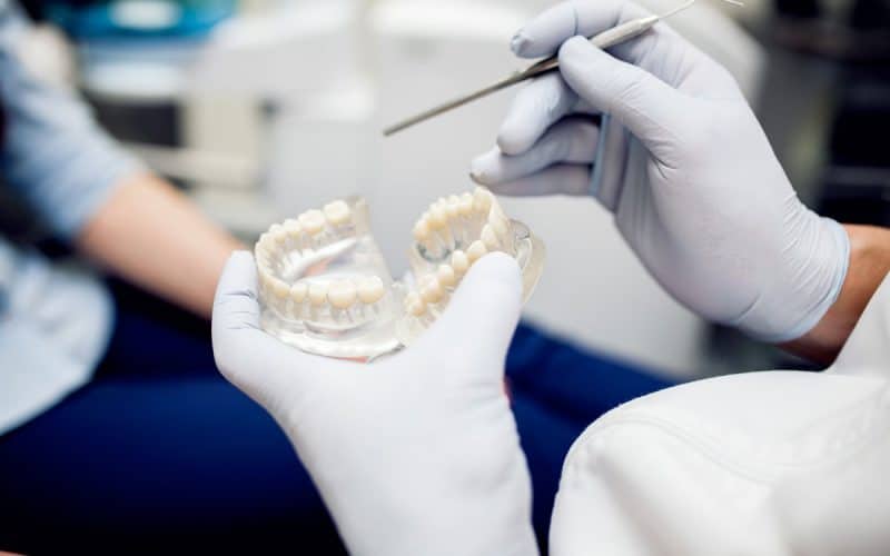 Cos’è una capsula dentale e quanto metterla?