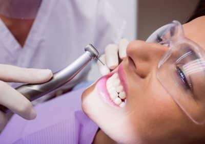 rimuovere il tartaro dai denti