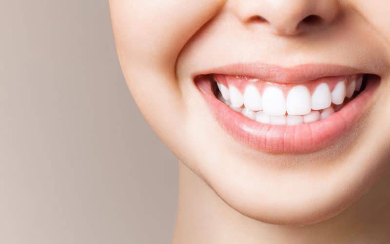 Bruxismo: cos’è e come si cura il digrignamento dei denti