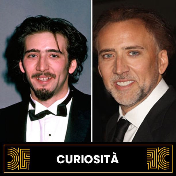 Sorriso Nicolas Cage prima dopo