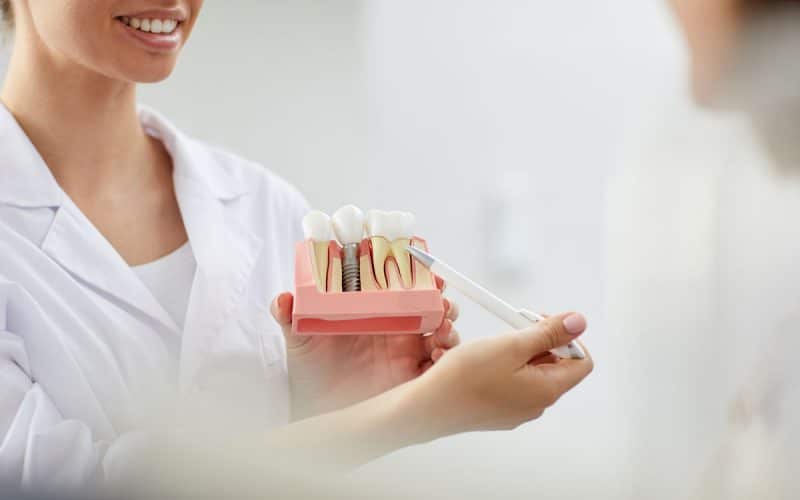 Impianti dentali con poco osso