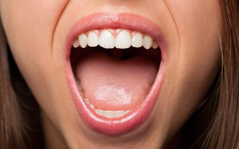 Morso aperto: cos’è  e come correggerlo con l’ortodonzia
