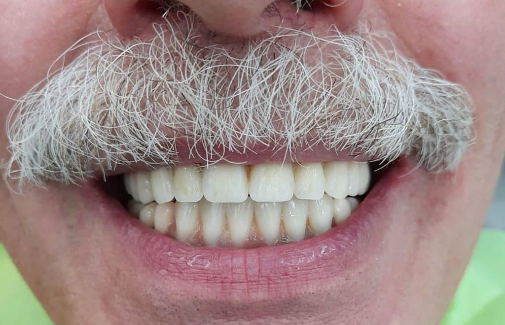 Dopo