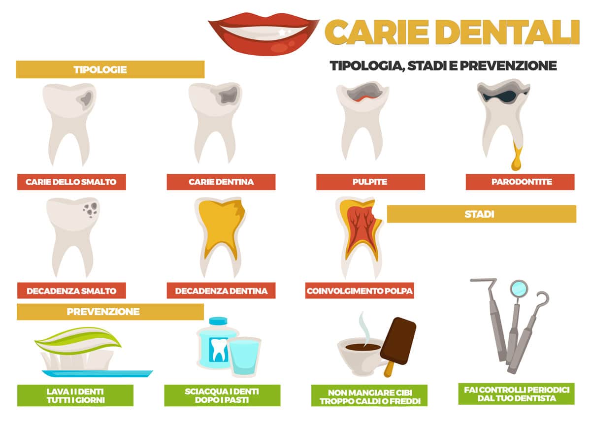 prevenzione e cura pulpite infografica