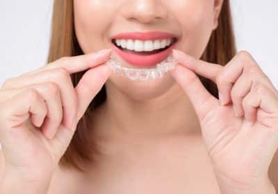 alternative invisalign