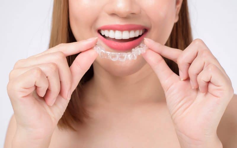 Alternative Invisalign per i trattamenti di Ortodonzia Invisibile
