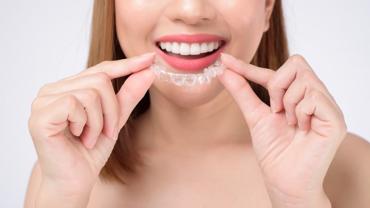 Alternative Invisalign per i trattamenti di Ortodonzia Invisibile