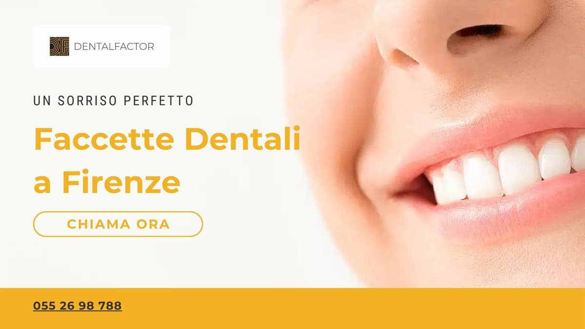 faccette dentali a firenze