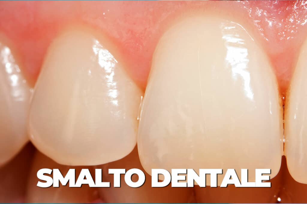 smalto dentale