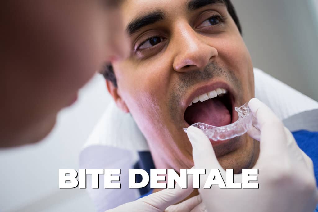 bite dentale