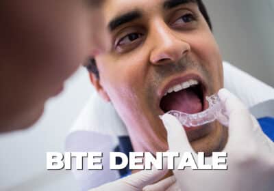 bite dentale