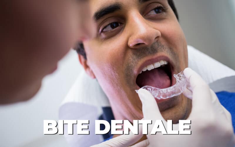 Bite Dentale: Tutto quello che c’è da sapere – Guida Definitiva 2023