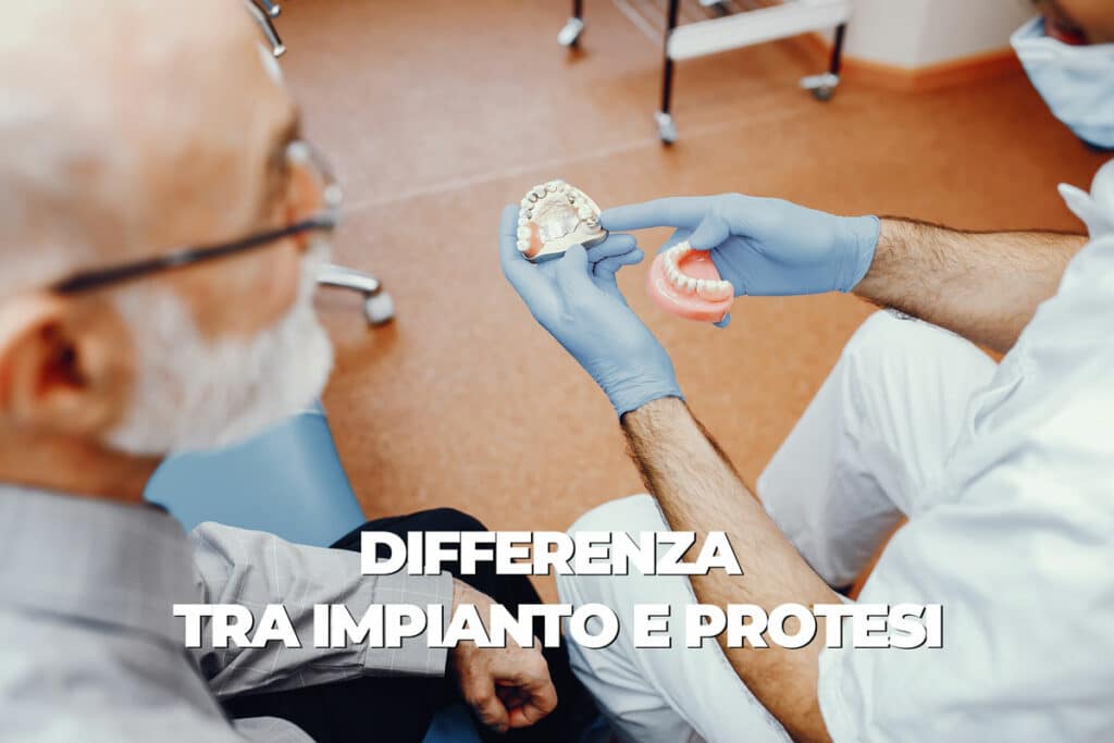 differenza tra impianto e protesi dentale
