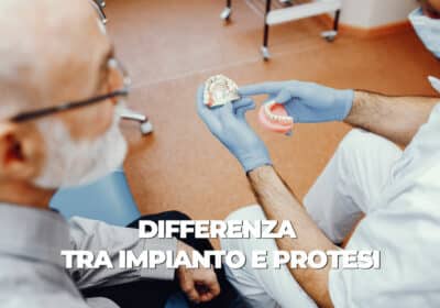 differenza tra impianto e protesi dentale