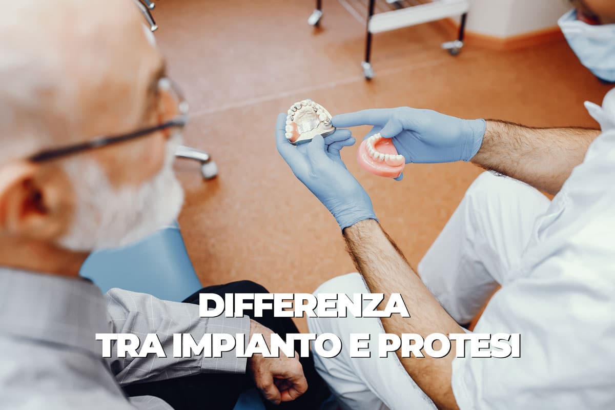 Che differenza c’è tra impianto e protesi?