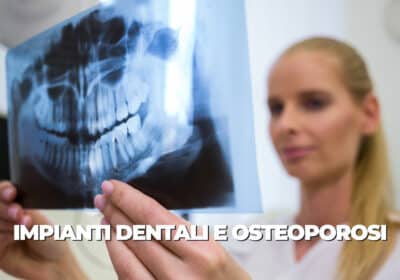 Impianti dentali e osteoporosi