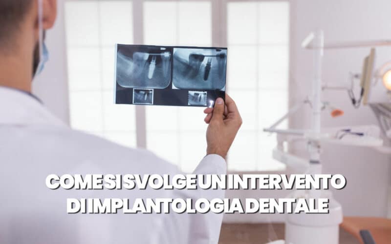 Come si svolge un intervento di implantologia dentale