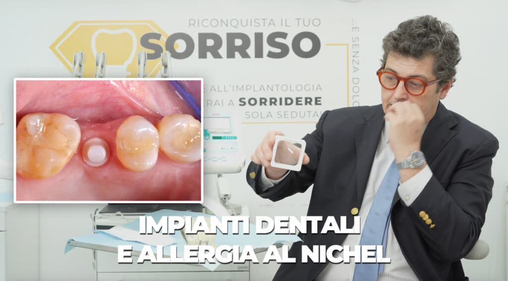 impianti dentali e allergia al nichel