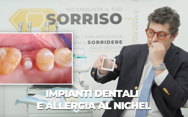 Impianti dentali e allergia al nichel