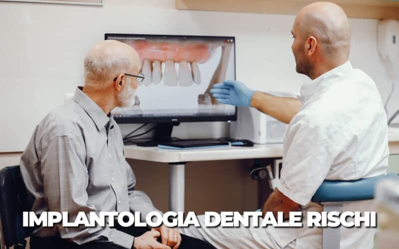 Implantologia Dentale rischi e preoccupazioni – Esiste il rigetto di un impianto dentale?