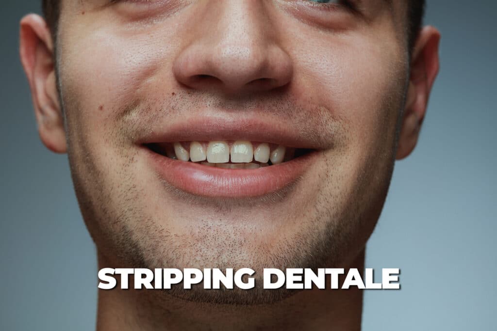 stripping dentale