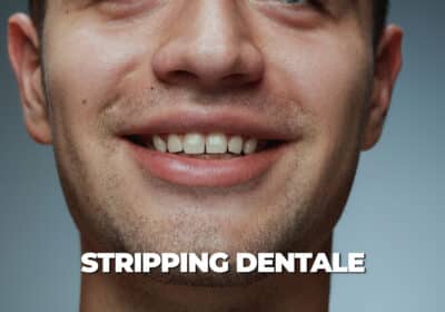 stripping dentale