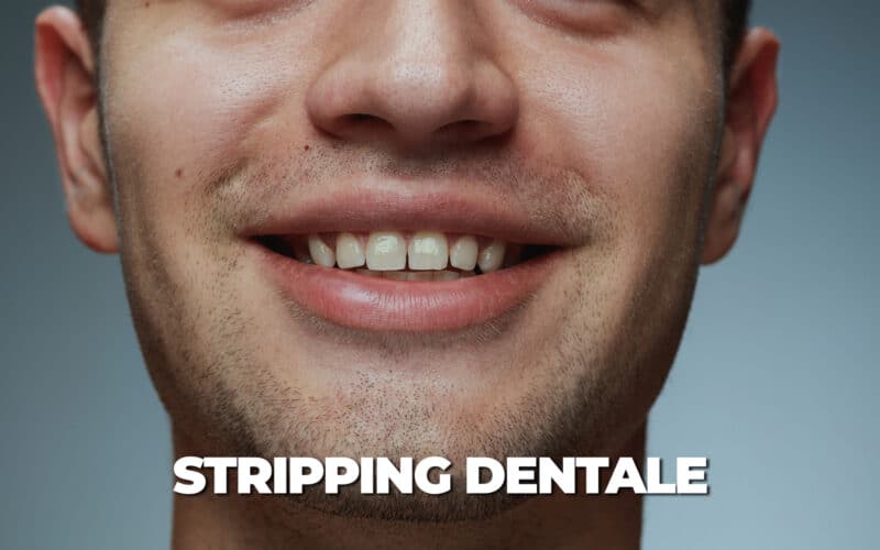 Stripping dentale: cos’è e come funziona in ortodonzia