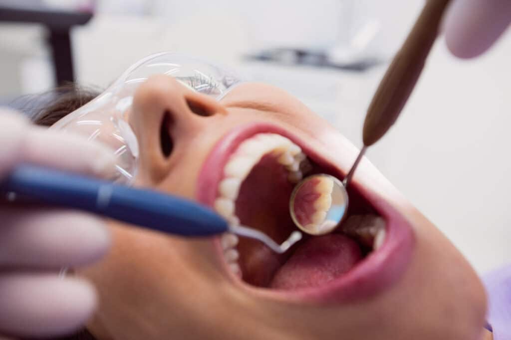 devitalizzare dente