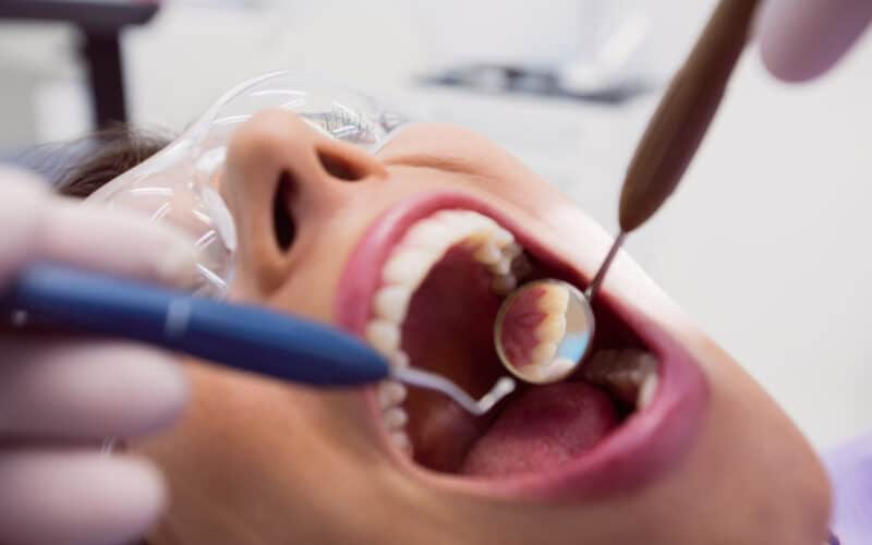 Devitalizzazione dente: cos’è e come funziona