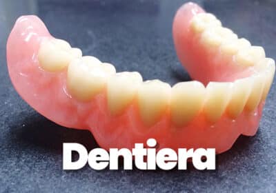 dentiera