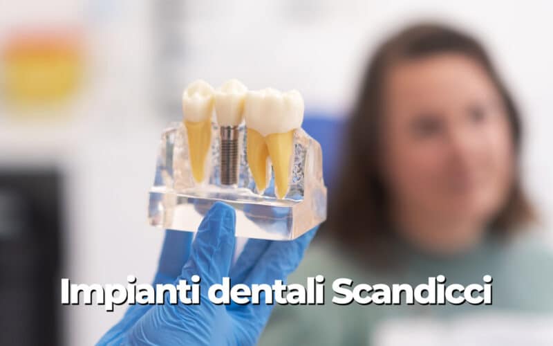 Impianti dentali Scandicci: sorriso fisso in 24-48h